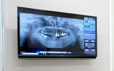 宇都宮市平松本町・ますやま歯科クリニック・ご説明用モニター